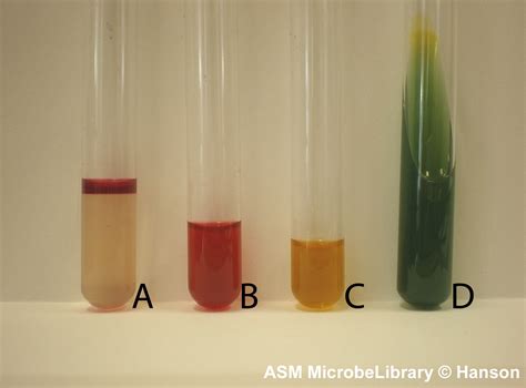 citrobacter freundii biochemical test results|IMViC Tests: Principle, Procedure, Results • Microbe Online.